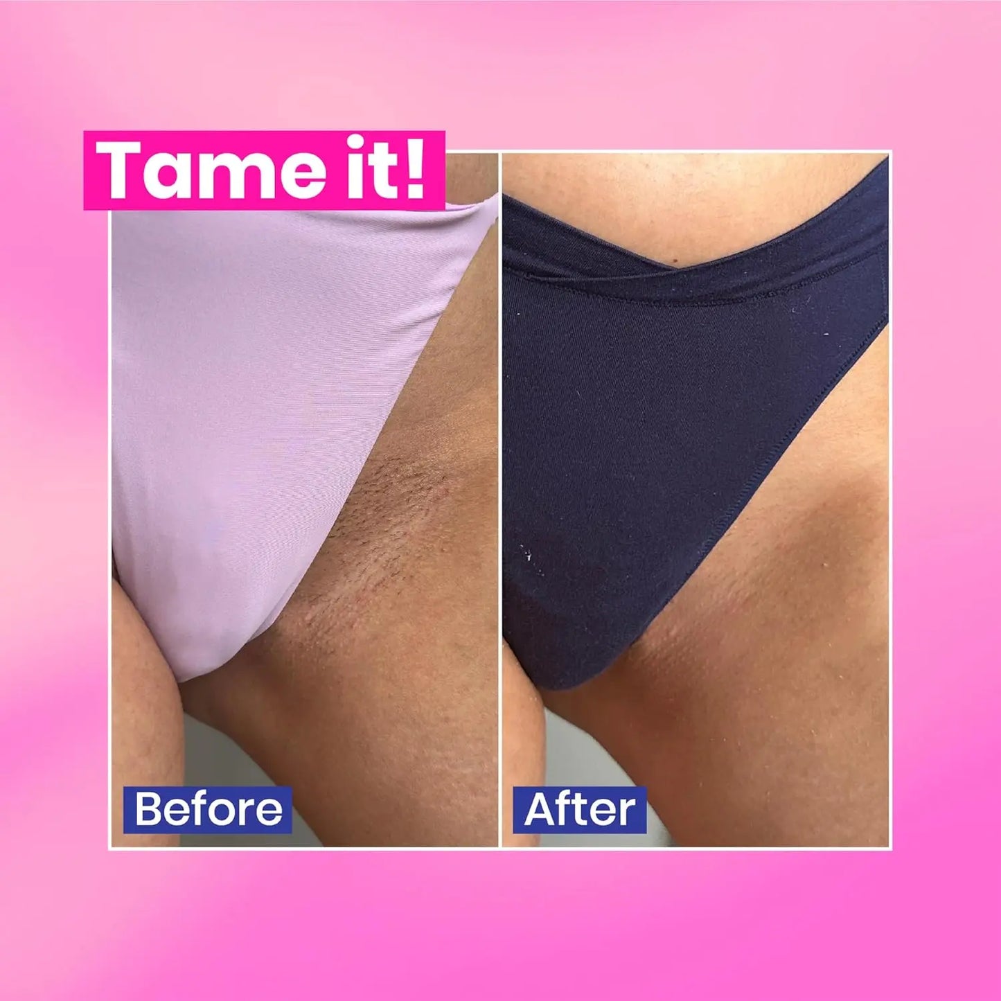 WooWoo Tame It! Natural Intimate Hair Removal Cream β Painless Vegan Depilatory for Sensitive Skin, Genitals, Bikini, Legs & Bum β Aloe Vera In-Shower Formula β 100ml